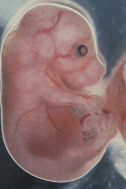 Figure 1: Vascular architecture of a mouse embryo...